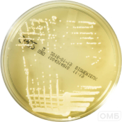 Sabouraud 2 Agar - Сабуро 2 агар