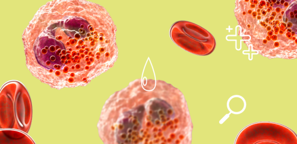Общий анализ крови и диагностика рака