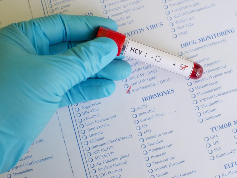 Важно – выявить скрытую HCV инфекцию