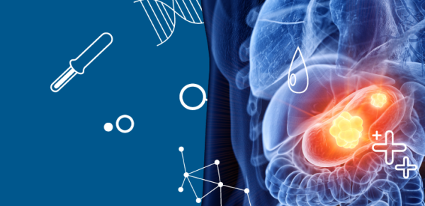 Роль гастрина-17 в диагностике рака желудка