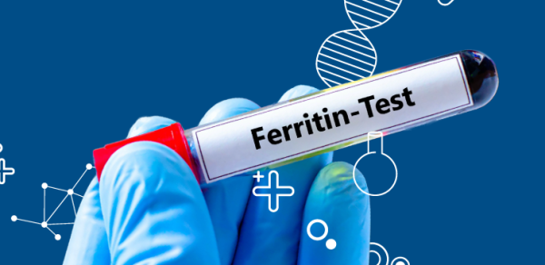 Ферритин как эффективный прогностический маркер иммунотерапии рака легких