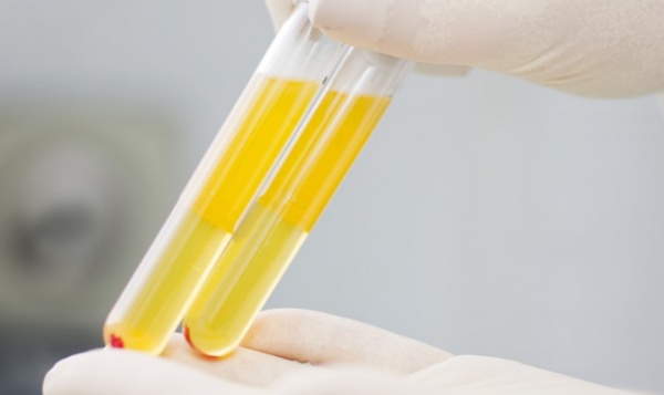 Что-то плавает в моей плазме?