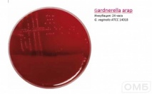 Gardnerella agar - Агар для селективного выделения Gardnerella vaginalis
