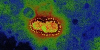 SARS-CoV-2 обнаружен в мокроте/кале после отрицательных образцов из глотки