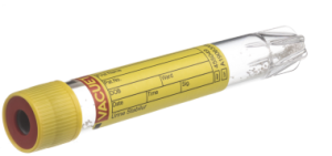 Пробирки вакуумные (9 мл, 16х100 мм, "VACUETTE", со стабилизатором Stabilur, для сбора мочи , без резьбы)