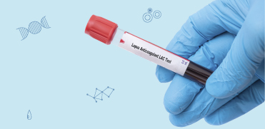 Диагностика Волчаночного антикоагулянта у пациентов с COVID-19