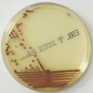 Селективный хромогенный агар для определения (скрининга) энтеробактерий, продуцирующих бета-лактамазы расширенного спектра действия - сhromID ESBL agar