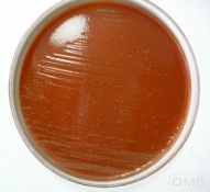 Haemophilus Chocolate 2 agar - Шоколадный агар для селективного выделения Haemophilus