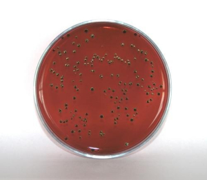 Eosin Methylene Blue Agar - Агар с эозином и метиленовым синим