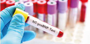 Определение NT-proBNP в практике специалиста