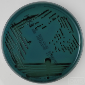 Hektoen agar - Агар для селективного выделения Salmonella и Shigella