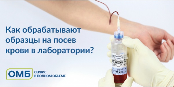 Как обрабатывают образцы на посев крови в лаборатории