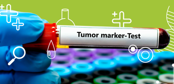 Диагностическая значимость опухолевых маркеров при раке легких