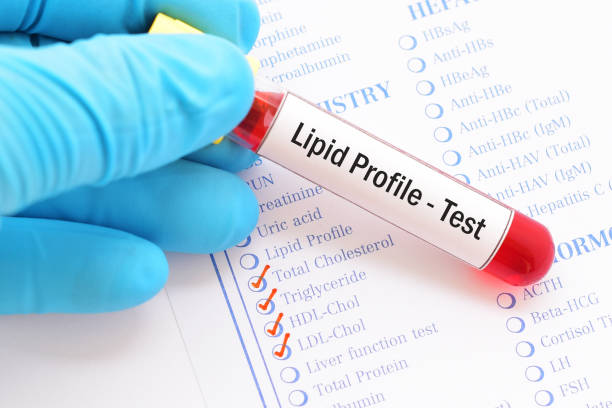 Нужен ли тест на Липопротеин (а)?