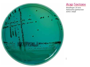 Hektoen agar - Агар для селективного выделения Salmonella и Shigella