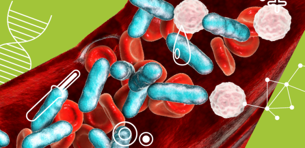Прокальцитонин как биомаркер бактериальной инфекции у пациентов в критическом состоянии