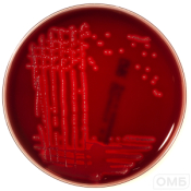 Gardnerella agar - Агар для селективного выделения Gardnerella vaginalis