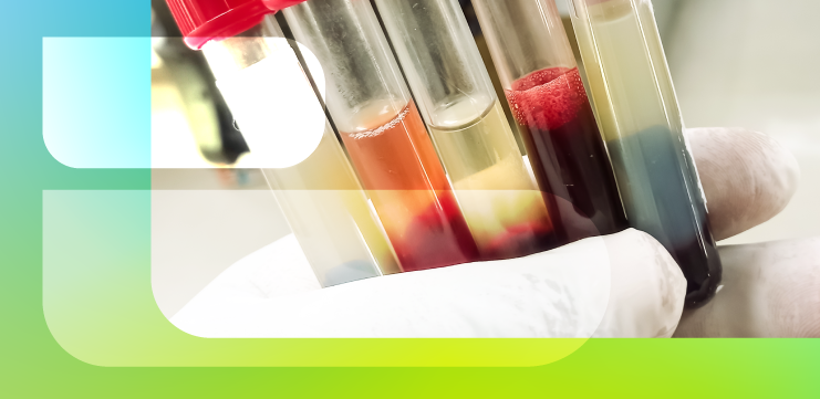 О чем предупреждает необычный цвет сыворотки