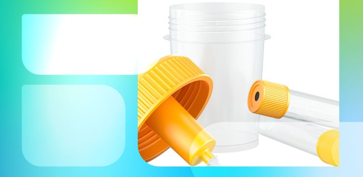 Нужны ли пробирки с консервантами для транспортировки мочи