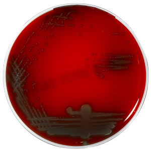 Columbia  ANC agar+ 5% sheep blood (CNА) - Колумбийский агар+ со смесью для селективного выделения грамположительных бактерий + 5%  бараньей крови