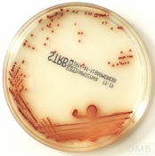 Селективная хромогенная среда для скрининга на  стрептококки группы В (S.Agalactiae) - сhromID Strepto B agar