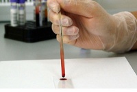 Простой анализ крови может улучшить исходы рака толстого кишечника