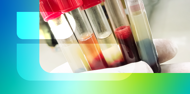 О чем предупреждает необычный цвет сыворотки